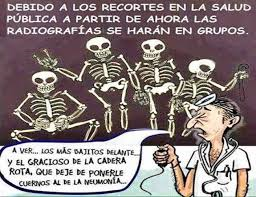 risas radiografias